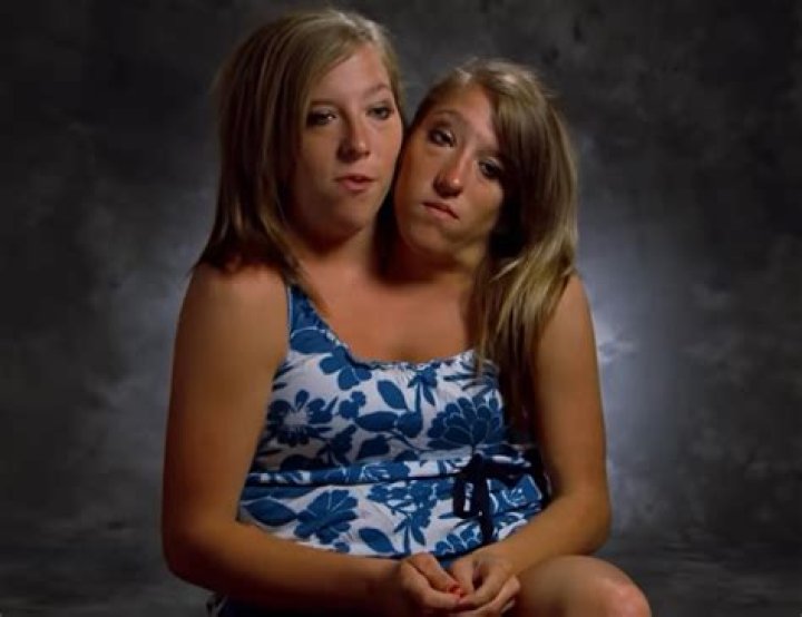 Abby Hensel Died: The Tragic End of a Conjoined Twins Life