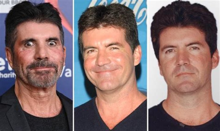 Simon Cowell Illness: Unveiling Rare Insights